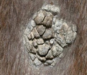 (Verrucous fig. 4)